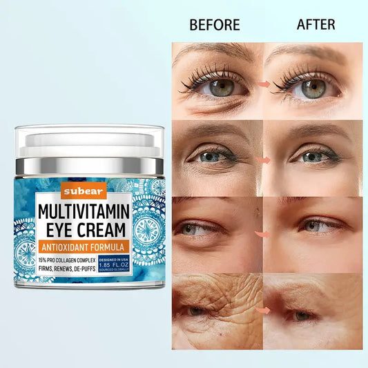 Eye Cream For Women